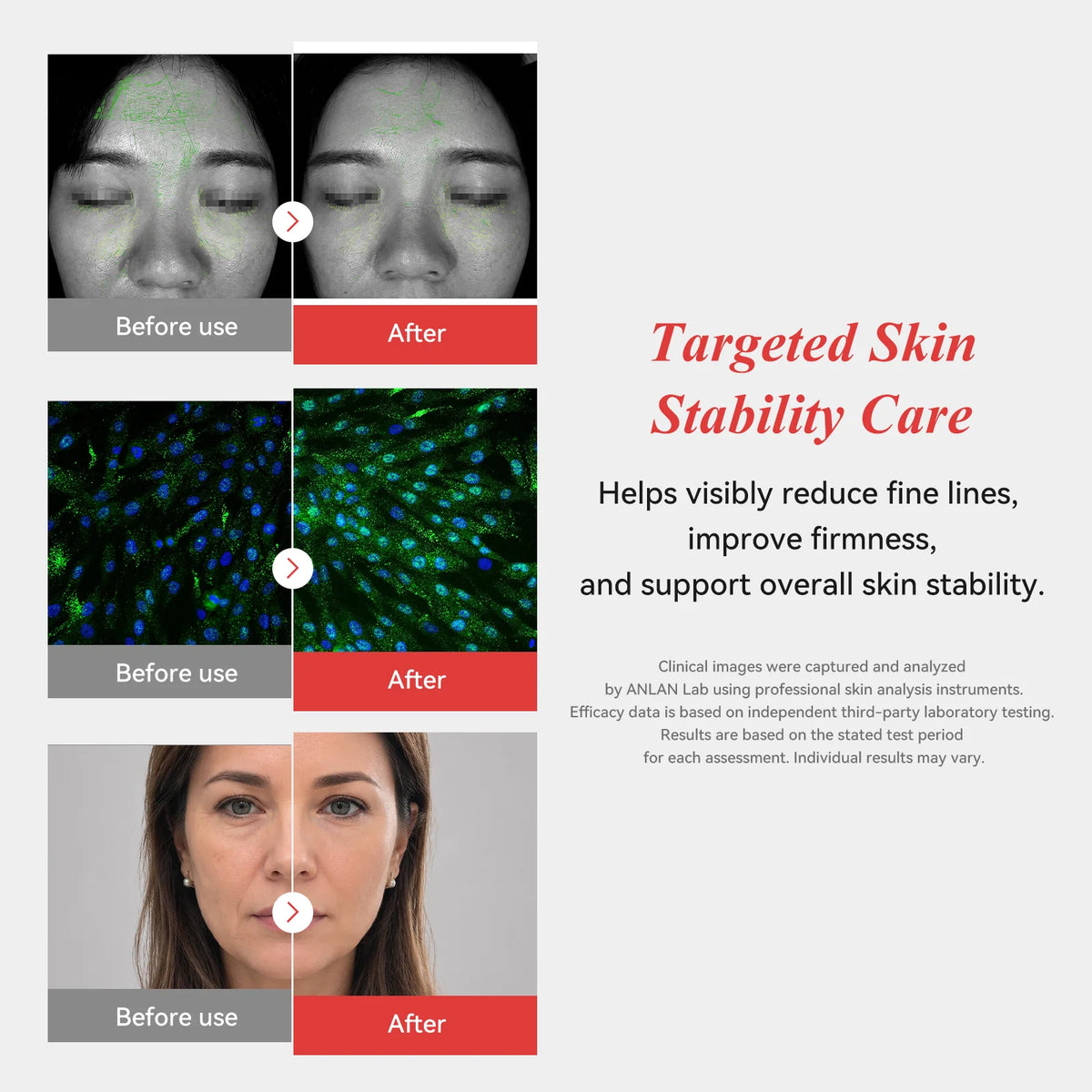 Rose Lumi LED & RF Face Device (ANLAN)