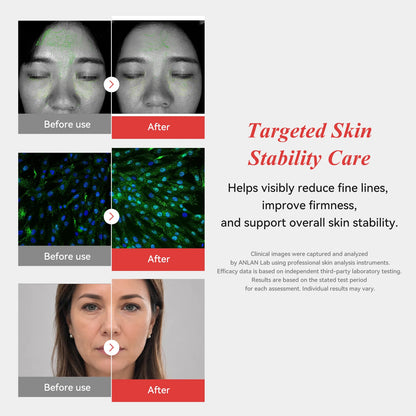 Rose Lumi LED & RF Face Device (ANLAN)