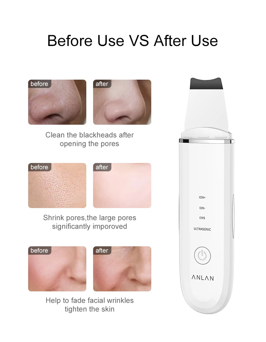 Skin Scrubber (ANLAN)