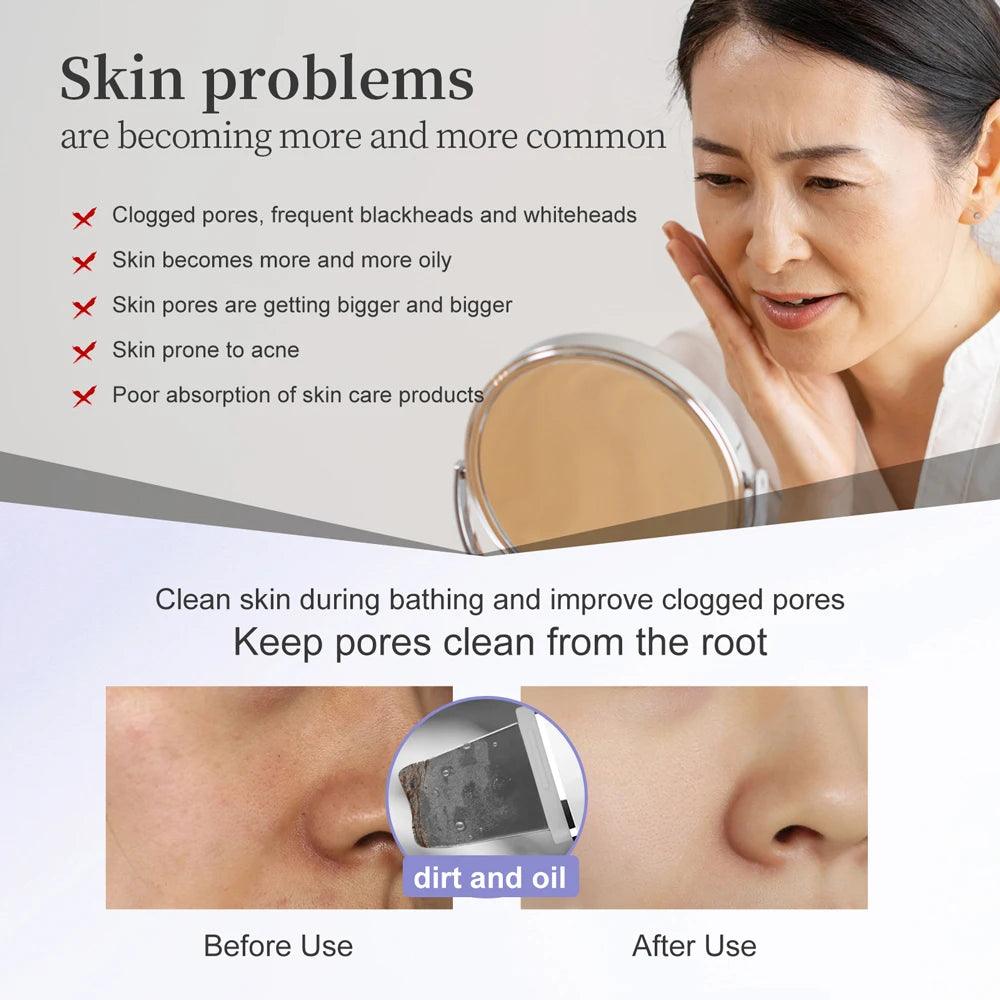 Ultrasonic Skin Scrubber (ANLAN)