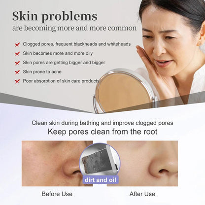 Ultrasonic Skin Scrubber (ANLAN)