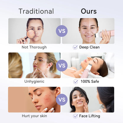 Skin Scrubber (ANLAN)