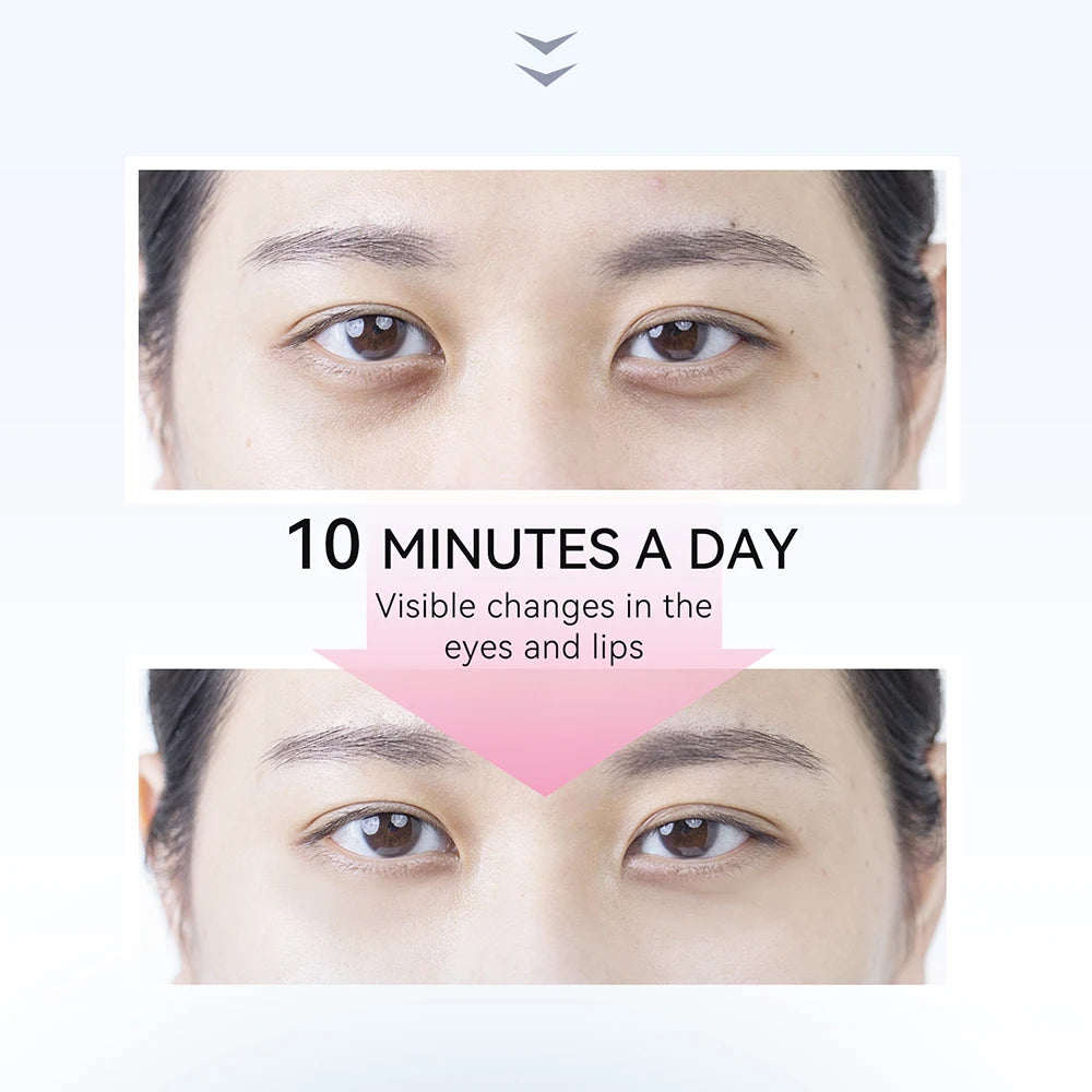 EyeLift Microcurrent Eye Device (ANLAN)