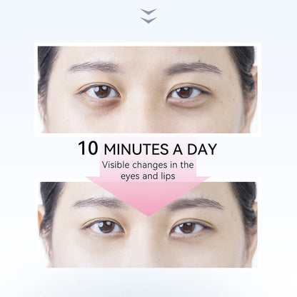EyeLift Microcurrent Eye Device (ANLAN)